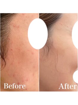 モット 神戸店(Motto)/フェイシャル