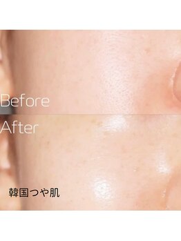 ハグミー 甲子園口(HUGME.)/つやつや/韓国ツヤ肌