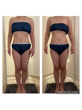 マナワ(Manawa)/お客様１回目ビフォーアフター