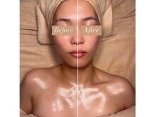 アンシャンテ(ENCHANTER)/小顔フェイシャル