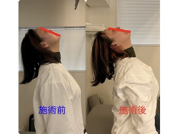 ルミエール(Rumiere)/首の可動域変化