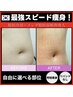 //最強スピード痩身//【痩せる脂肪冷却＋メシダ脂肪分解導入】