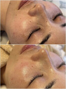 ビエン(bien)/大人トラブル肌にプラズマニア！