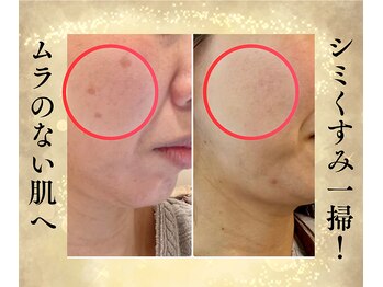 サンテボーテ(Sante Beaute)/50代の肌悩みをすべて一掃