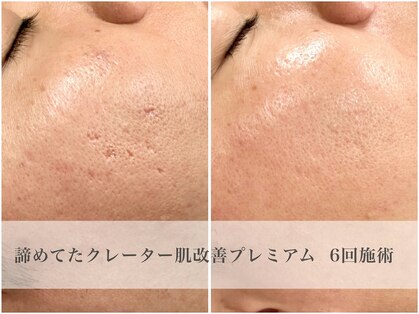 カヌヌ(kanunu)の写真