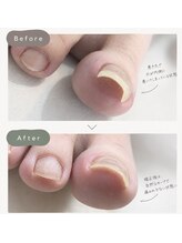 ネイルホーラー(Nail-HAULER)