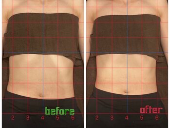 イチ(ichi)/内臓ケア 一回の変化