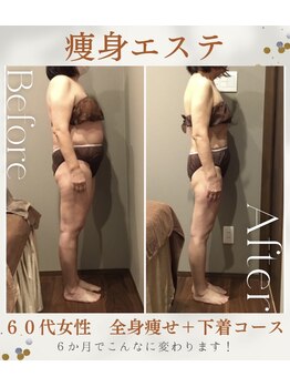 ムーン(MOON)/60代女性痩身エステ４ヶ月