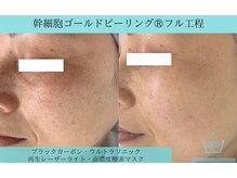 リメイククリニカルビューティー(Remake clinical beauty)/シミ悩み、くすみケア