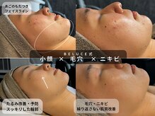 ベルーチェ(Beluce)