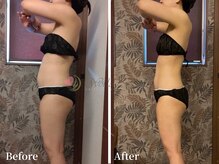 ワールドビューティー(World Beauty)/滝汗デトックス×強圧リンパ痩身