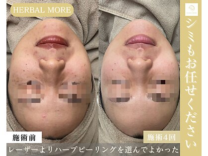 サロン ド レナ(Salon de LENA)の写真