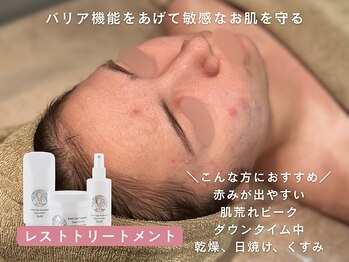 サンゴ(Sango)/レストセルトリートメント