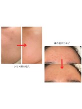 トモニ(TOMONI)/肌質改善サロン　TOMONI