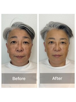 アスト(AST)/50代★むくみ解消スッキリ小顔に