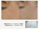 ボーテラボ 大宮(beaute LABO)の写真/夏枯れ肌をリセット！『頑固な毛穴詰まり』、ワックスですっきりオフしませんか？
