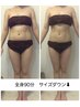 【美脚・美くびれGET】気になる贅肉撃退！痩身業界の神の手マシン★全身100分