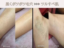 レオン(REONE)/【確かな知識と豊富な経験◎】