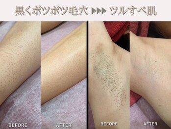 レオン(REONE)/【確かな知識と豊富な経験◎】