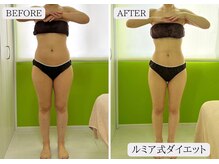 ルミア 函館店(LuMia)/3ヶ月で8kg～12kg減の全身痩せ！