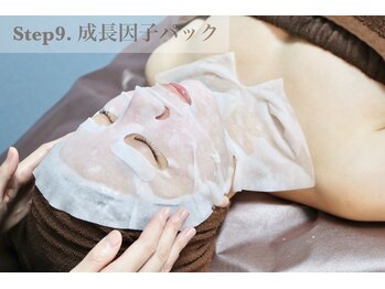 ノーブル 新宿南口(NOBLE)/剥離　ハーブピーリング　工程9