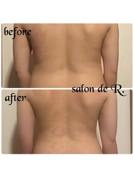 サロン ド アール(salon de R.)/【お背中骨氣・20代・施術効果】