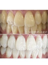 ホワイトニングルーム 川崎店(WhiteningRoom)/ホワイトニング/川崎