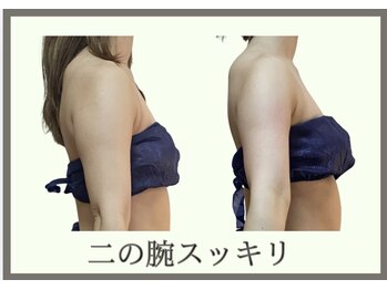 ヨサパーク コクリ(YOSA PARK kokuRi)/ノースリーブも怖くない