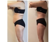 ラヴィアンローズ 岐阜本店(La vie en Rose)の雰囲気（スペシャル集中施術6ヶ月《お腹・二の腕・足・背中》）