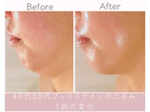 エービューティ(A.beauty)