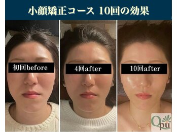 キュープ 表参道店(Qpu)の写真/「また来たい！」の声多数！小顔矯正も回数券でお得に◎長く通えるお気に入りサロンに是非！