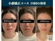 キュープ 表参道店(Qpu)の写真/「また来たい！」の声多数！小顔矯正も回数券でお得に◎長く通えるお気に入りサロンに是非！