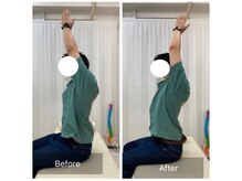 ナオル整体 三鷹院(NAORU整体)/30代男性施術事例【肩関節屈曲】