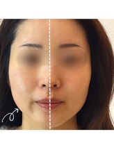 美バリ 新宿店(美BARI)/エアバリ