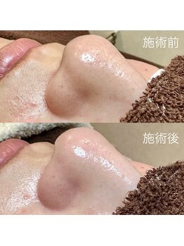 エクラ バイ シャンリィ(eclat by shanLy)/触りたくなるお肌に