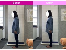 八女整体院/～姿勢改善～股関節の痛み