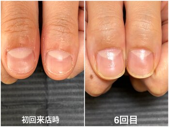 【自爪育成】コース６回目の様子