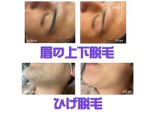 セイクレッド フィットネス(Sacred Fitness)の雰囲気（冷却作用で少ない痛みで行え高い効果が期待できる最新機器です）