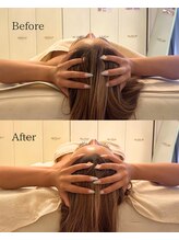 ボインラボ(Boin Labo)/脳内洗浄で腕まで細くなった！？