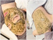 ミヌ 心斎橋(Minou)/お顔+お背中のハーブピーリング