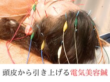 健美庵の雰囲気（【リフトアップ】美容鍼に電気を通すて頭からしっかり引き上げ！）