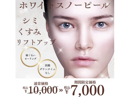 ラキ(LAKI)の写真