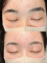 アイモア 吉祥寺店(eye mor.)/まつげパーマ/眉毛/アイブロウ