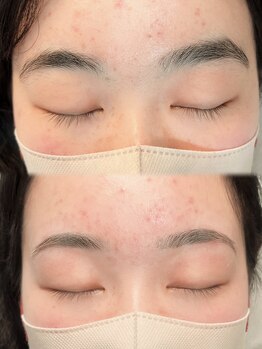 アイモア 吉祥寺店(eye mor.)/まつげパーマ/眉毛/アイブロウ