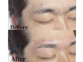 アカヌケ(AKANUKE)/眉毛ワックス脱毛