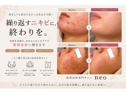ネオ 熊本玉名(neo)の写真