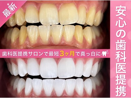 エクシアホワイトニング 札幌琴似店の写真