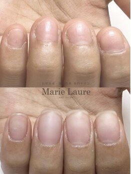 マリーロール 天王寺店(Marie Laure)/自爪育成/深爪矯正/ネイルケア