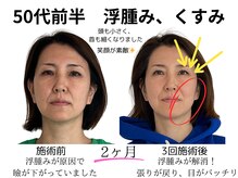 ムーン(Moon)