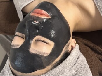 ミューベル(MYubelle)/水光ピーリングでトラブル改善♪